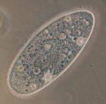 Betty used Paramecium aurelia to demonstrate photoreactivation in eukaryotes. Credit: Barfooz, CC BY-SA 3.0